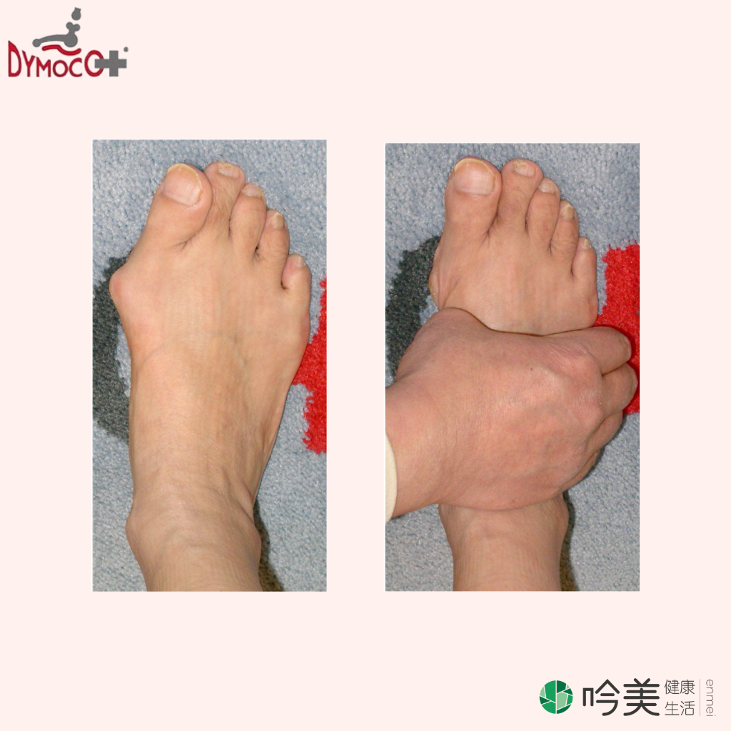 【DYMOCO】日本DYMOCO足弓綁帶(一雙) D'r DYMOCO Taping理論 - 吟美健康生活